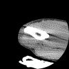 SPORK, NICO - 22.03.1976 - 02.08.2022 - CT obere Extremität - 17:51:17